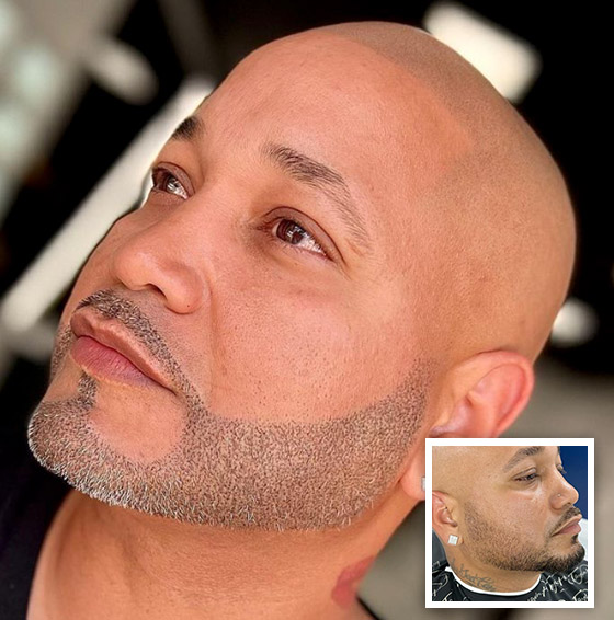 smp-results-before-and-after-hair-tattoo-taylor-perry-14